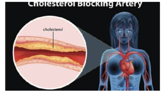 എന്താണ് കൊളസ്ട്രോൾ…?